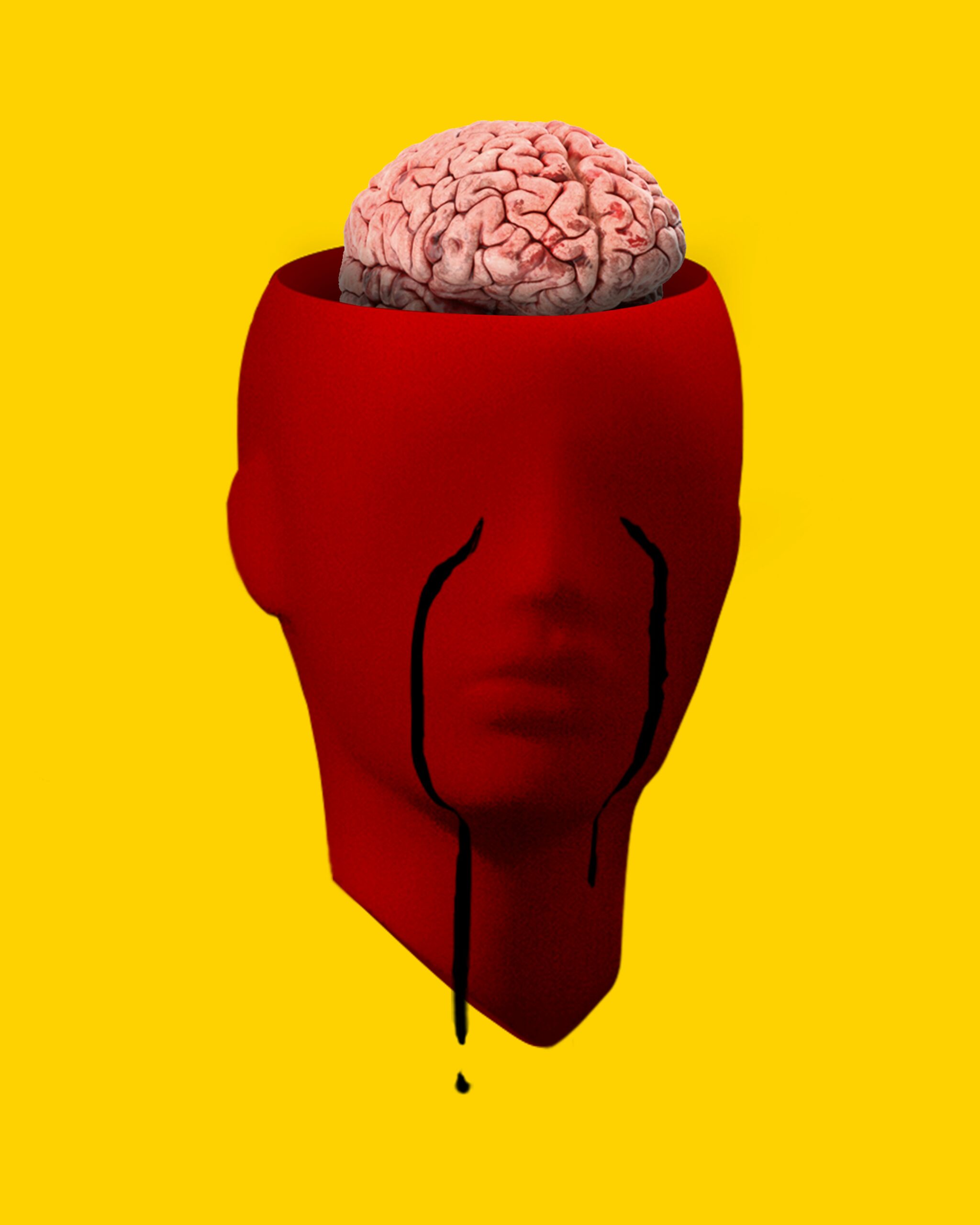 parkinson's brain